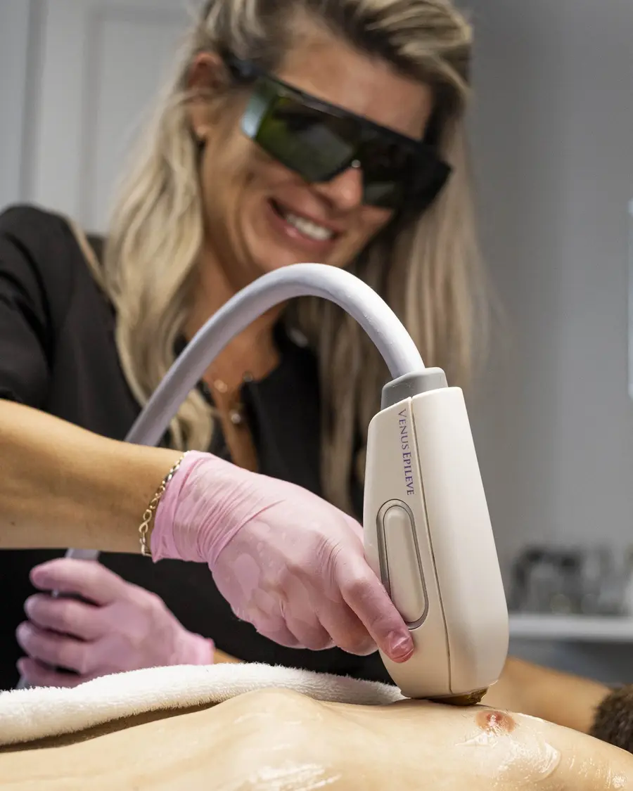 Stéphanie, lunettes de protection, pièce à main du laser sur un torse